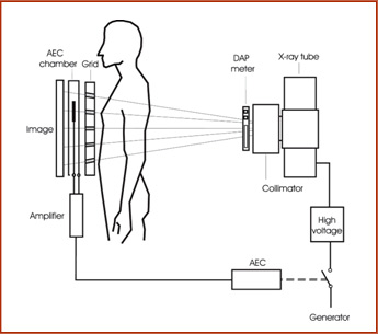 Схема використування, іонізаційна камера AEC Sensor